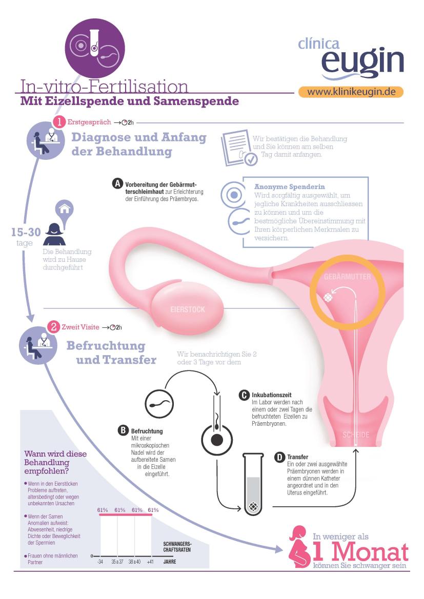IVF